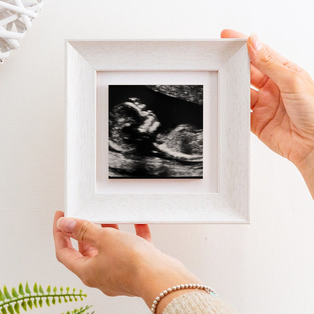 pregnancy scan ceramic photo tile frame
